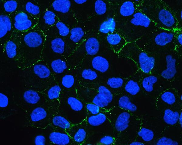 IHC - Anti-E Cadherin 1 CDH1 Antibody Picoband™ (monoclonal, 9G2) ABO14856